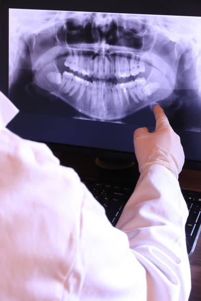 Best Knocked-Out Tooth (Avulsed Tooth) Treatment in Garretson, SD