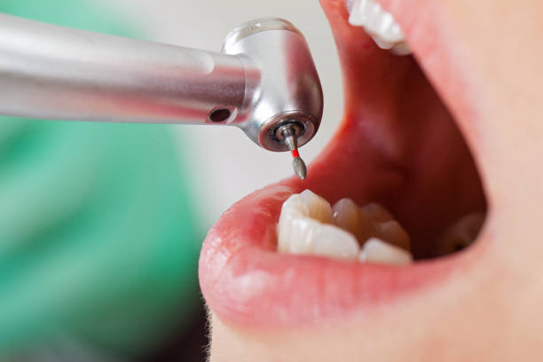 Best Emergency Dental Care for Sports Injuries in Garretson, SD